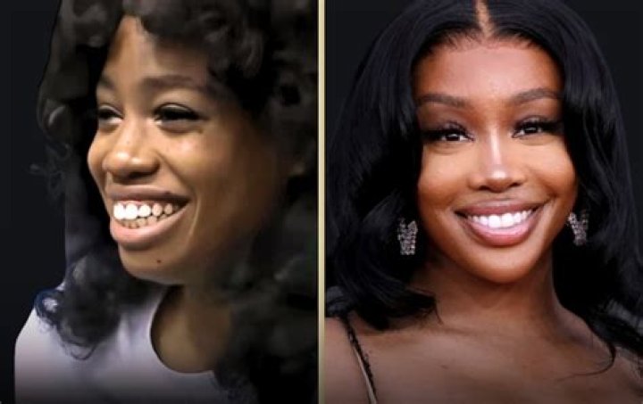 Discoveries Unmasked: SZA's Surgery Journey Unveiled